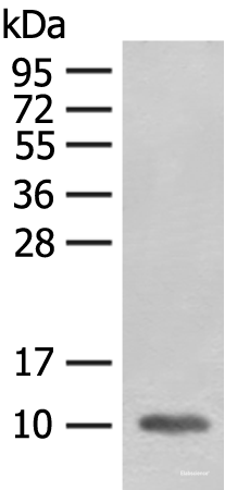 Western blot analysis of Mouse heart tissue lysate using FABP4 Polyclonal Antibody at dilution of 1:400