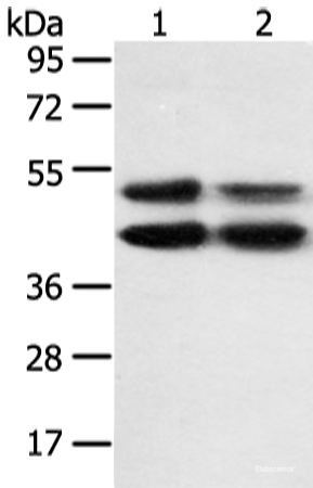 Western blot analysis of K562 and hela cell using MAPK8 Polyclonal Antibody at dilution of 1:600