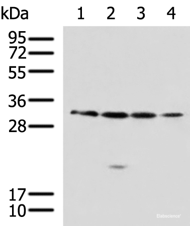 Western blot analysis of 293T A549 Jurkat 231 cell lysates using RCHY1 Polyclonal Antibody at dilution of 1:650