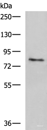 Western blot analysis of Human skin tissue lysate using TGM3 Polyclonal Antibody at dilution of 1:1600