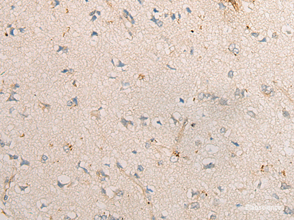 Immunohistochemistry of paraffin-embedded Human brain tissue using PPM1D Polyclonal Antibody at dilution of 1:60(×200)