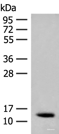 Western blot analysis of Human fetal brain tissue lysate using AKAP7 Polyclonal Antibody at dilution of 1:200