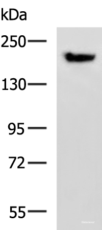 Western blot analysis of Mouse brain tissue lysate using PDS5B Polyclonal Antibody at dilution of 1:800