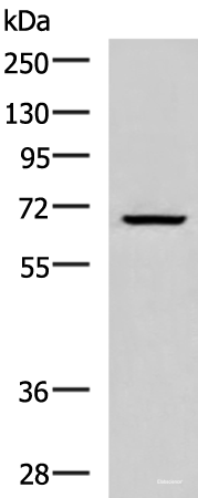 Western blot analysis of Raji cell lysate using CACNB1 Polyclonal Antibody at dilution of 1:800