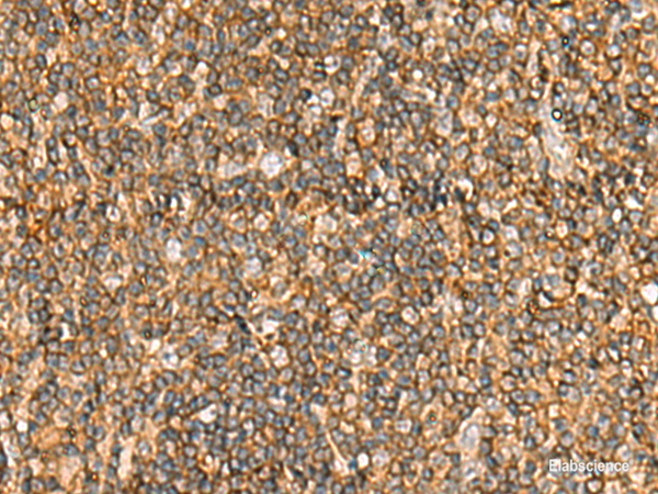 Immunohistochemistry of paraffin-embedded Human tonsil tissue using NLRC4 Polyclonal Antibody at dilution of 1:50(×200)