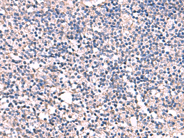 Immunohistochemistry of paraffin-embedded Human tonsil tissue using ESM1 Polyclonal Antibody at dilution of 1:55(×200)