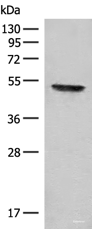 Western blot analysis of Mouse thymus tissue lysate using FGL2 Polyclonal Antibody at dilution of 1:300