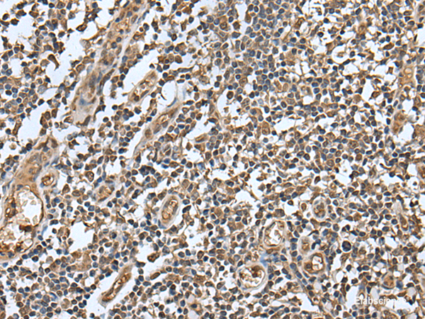 Immunohistochemistry of paraffin-embedded Human tonsil tissue using LAMTOR5 Polyclonal Antibody at dilution of 1:55(×200)