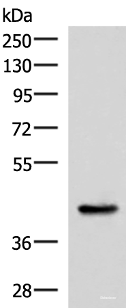 Western blot analysis of Mouse liver tissue lysate using HPN Polyclonal Antibody at dilution of 1:550