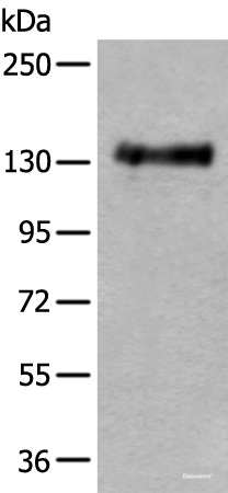 Western blot analysis of Mouse brain tissue lysate using PTPRA Polyclonal Antibody at dilution of 1:400