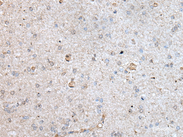 Immunohistochemistry of paraffin-embedded Human brain tissue using RAB4A Polyclonal Antibody at dilution of 1:40(×200)