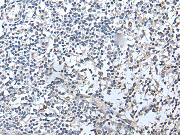 Immunohistochemistry of paraffin-embedded Human tonsil tissue using RERG Polyclonal Antibody at dilution of 1:50(×200)
