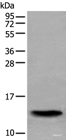 Western blot analysis of Human normal stomach tissue lysate using SAA4 Polyclonal Antibody at dilution of 1:350