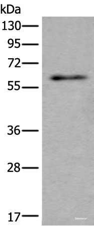 Western blot analysis of Mouse testis tissue lysate using SCP2 Polyclonal Antibody at dilution of 1:350