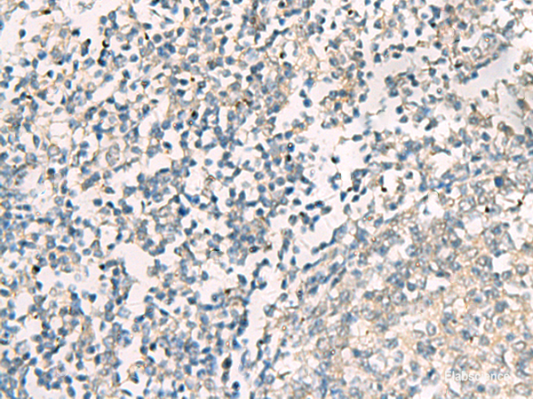 Immunohistochemistry of paraffin-embedded Human tonsil tissue using SERPINB4 Polyclonal Antibody at dilution of 1:40(×200)