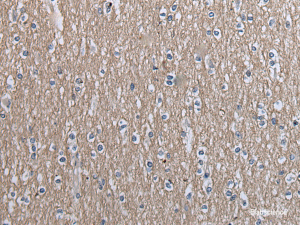 Immunohistochemistry of paraffin-embedded Human brain tissue using SLC39A14 Polyclonal Antibody at dilution of 1:40(×200)