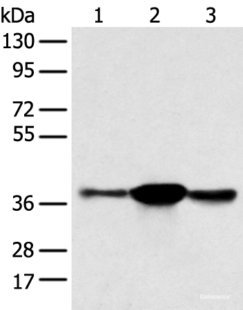 Western blot analysis of K562 A375 and 231 cell using SPRY4 Polyclonal Antibody at dilution of 1:400