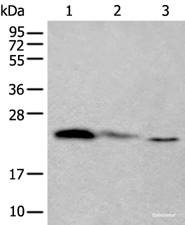 Western blot analysis of 293T and Hela cell lysates using TPT1 Polyclonal Antibody at dilution of 1:450