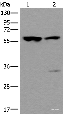 Western blot analysis of Mouse testis tissue and Human testis tissue lysates using TRIM27 Polyclonal Antibody at dilution of 1:400