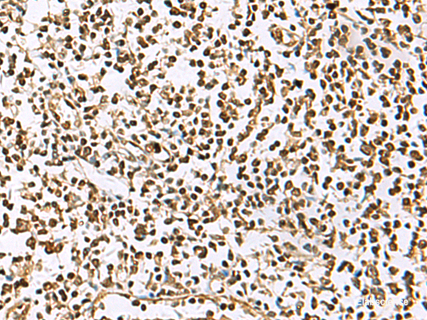 Immunohistochemistry of paraffin-embedded Human tonsil tissue using UBLCP1 Polyclonal Antibody at dilution of 1:85(×200)
