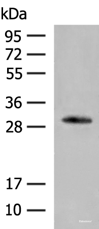 Western blot analysis of Human left thymus tissue lysate using VDAC3 Polyclonal Antibody at dilution of 1:200