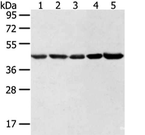 Western blot analysis of Hela lncap NIH/3T3 K562 and 231 cell using WDR77 Polyclonal Antibody at dilution of 1:500