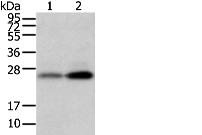 Western blot analysis of Mouse trachea and brain tissue using WFDC5 Polyclonal Antibody at dilution of 1:1100