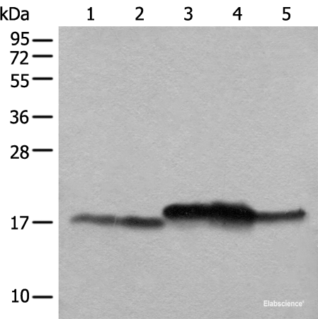 Western blot analysis of Mouse brain tissue Mouse liver tissue 231 cell K562 cell A431 cell lysates using NDUFB11 Polyclonal Antibody at dilution of 1:1000