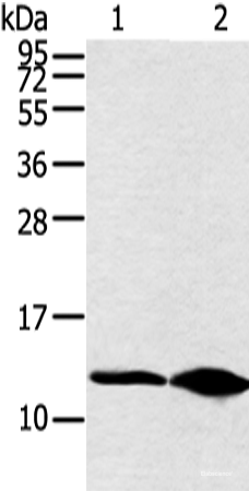 Western blot analysis of Hela cell and human fetal brain tissue using DYNLL2 Polyclonal Antibody at dilution of 1:250