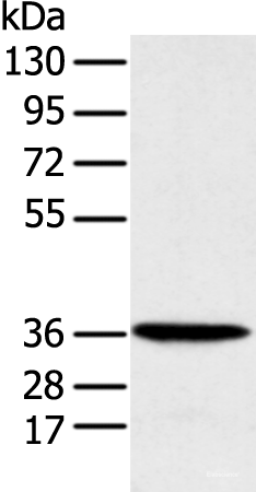 Western blot analysis of Human fetal liver tissue using MAT2B Polyclonal Antibody at dilution of 1:1000