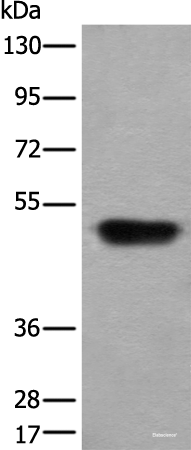 Western blot analysis of Human fetal liver tissue lysate using HNRNPH2 Polyclonal Antibody at dilution of 1:400