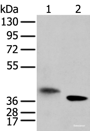 Western blot analysis of A172 cell and mouse kidney tissue using LRRC19 Polyclonal Antibody at dilution of 1:450