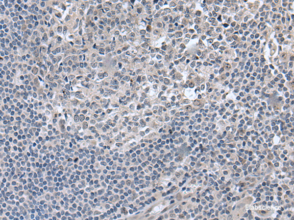 Immunohistochemistry of paraffin-embedded Human tonsil tissue using EDARADD Polyclonal Antibody at dilution of 1:50(×200)