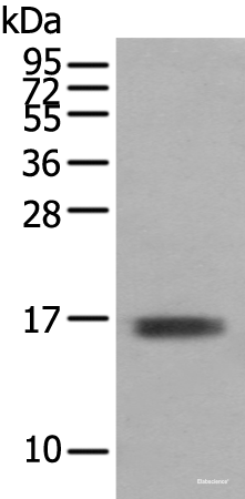 Western blot analysis of Mouse skeletal muscle tissue using TNNC1 Polyclonal Antibody at dilution of 1:400