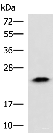 Western blot analysis of Human fetal liver tissue lysate using ABHD14B Polyclonal Antibody at dilution of 1:900