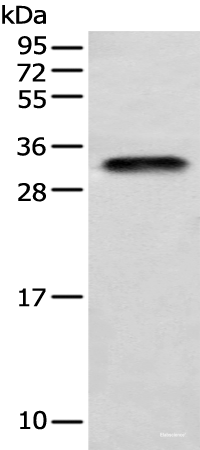 Western blot analysis of Human testis tissue using LYPD4 Polyclonal Antibody at dilution of 1:400