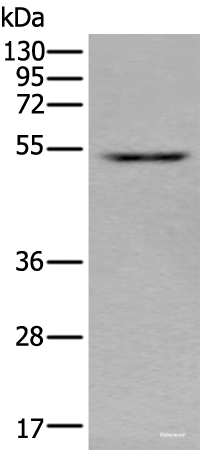 Western blot analysis of HEPG2 cell lysate using ZNF672 Polyclonal Antibody at dilution of 1:350
