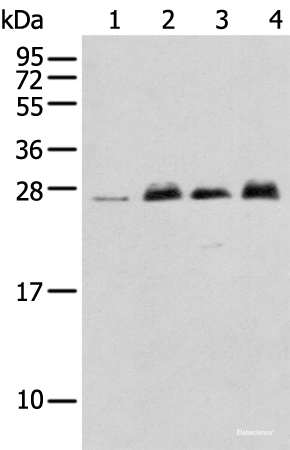 Western blot analysis of K-562 cell Mouse brain tissue Rat brain tissue Human fetal brain tissue using MOB4 Polyclonal Antibody at dilution of 1:400