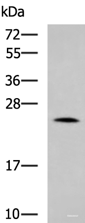 Western blot analysis of Mouse small intestines tissue lysate using LYPLA1 Polyclonal Antibody at dilution of 1:1000