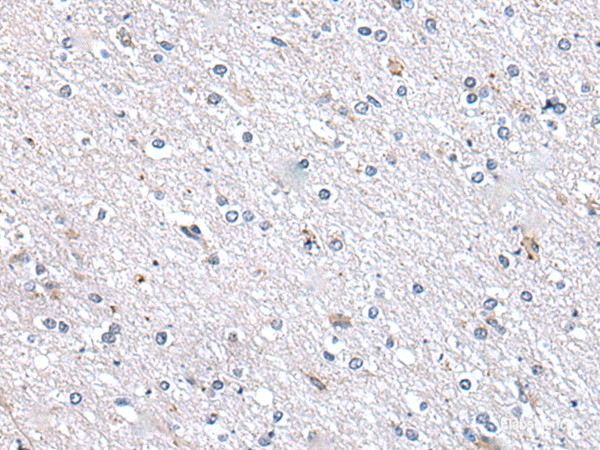 Immunohistochemistry of paraffin-embedded Human brain tissue using METTL7A Polyclonal Antibody at dilution of 1:40(×200)