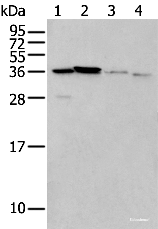 Western blot analysis of 293T cell Mouse brain tissue and Human kidney tissue lysates using LASP1 Polyclonal Antibody at dilution of 1:350