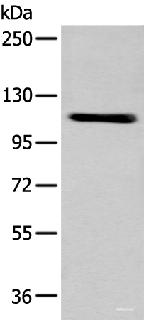 Western blot analysis of A549 cell using ZNF281 Polyclonal Antibody at dilution of 1:600