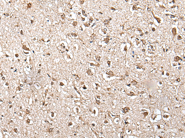 Immunohistochemistry of paraffin-embedded Human brain tissue using ZFP36 Polyclonal Antibody at dilution of 1:55(×200)
