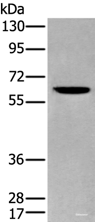 Western blot analysis of Human cerebrum tissue lysate using ZKSCAN1 Polyclonal Antibody at dilution of 1:400