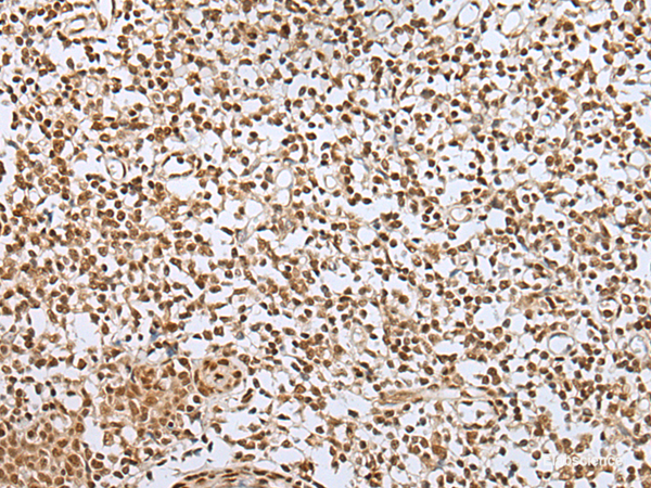 Immunohistochemistry of paraffin-embedded Human tonsil tissue using ZNF354A Polyclonal Antibody at dilution of 1:40(×200)