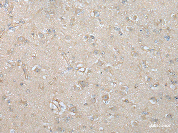 Immunohistochemistry of paraffin-embedded Human brain tissue using VILL Polyclonal Antibody at dilution of 1:65(×200)