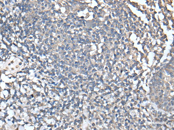 Immunohistochemistry of paraffin-embedded Human tonsil tissue using UBASH3A Polyclonal Antibody at dilution of 1:50(×200)