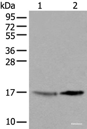 Western blot analysis of 231 cell and Human cerebrum tissue lysates using UBE2W Polyclonal Antibody at dilution of 1:550
