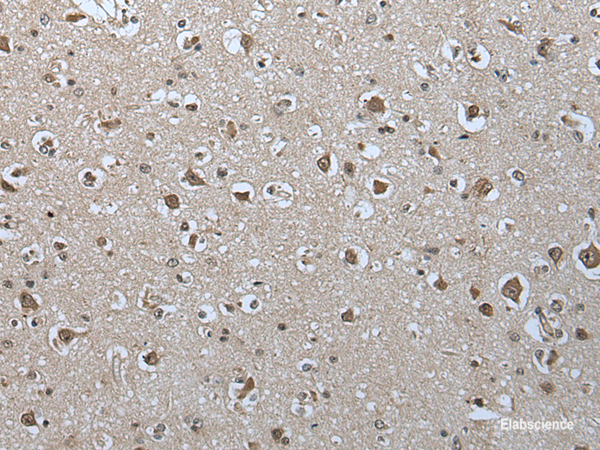Immunohistochemistry of paraffin-embedded Human brain tissue using USP35 Polyclonal Antibody at dilution of 1:55(×200)