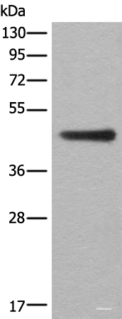 Western blot analysis of A431 cell lysate using ASS1 Polyclonal Antibody at dilution of 1:300